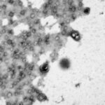 Rájöttek a sejtbiológia 40 éves rejtélyére