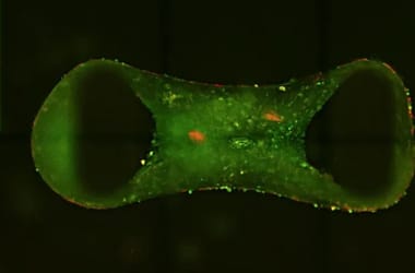 Szívbetegek, figyelem: laborban növesztenek aprócska emberi szíveket, az orvostudomány régi nagy kihívását oldhatják meg