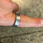 Megsérült az akkumulátor, rászorult a Samsung okosgyűrűje a felhasználó ujjára – fotók